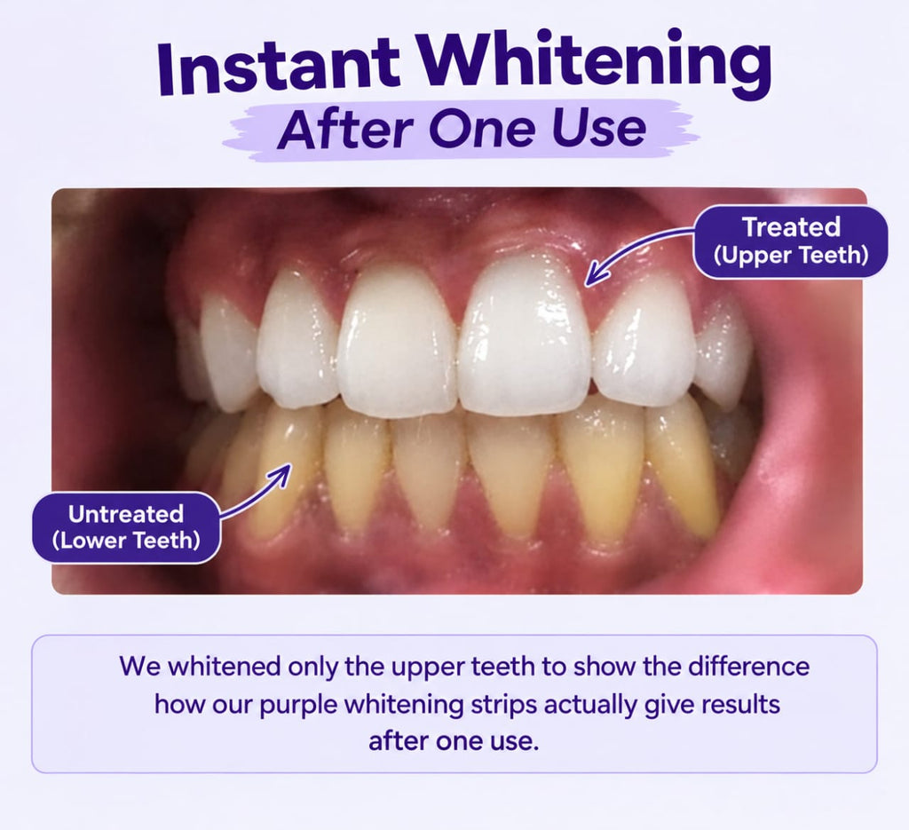AERO SMILE - 14X Purple Teeth Whitening Strips ( Instant Whitening )