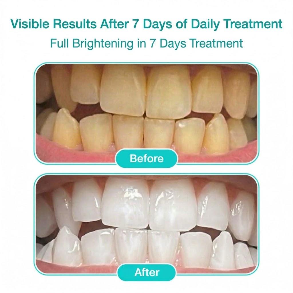 AERO SMILE - Teeth Whitening Strips (Ultra Strong Whitening)