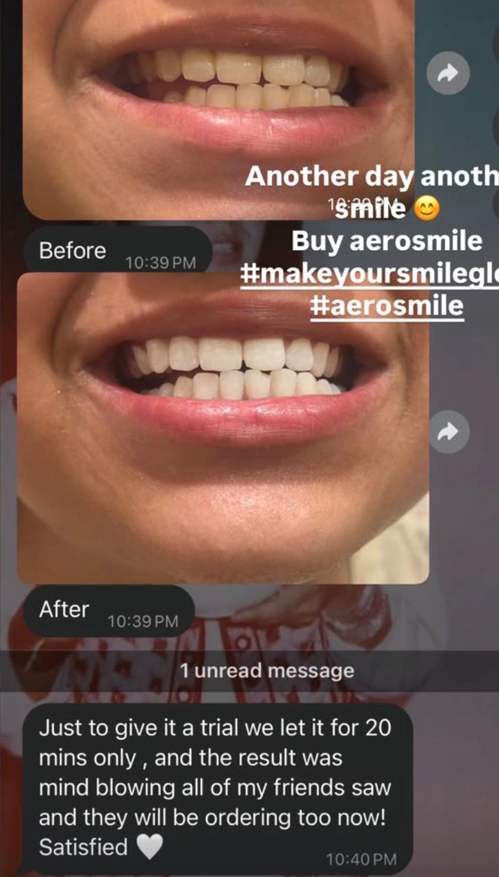 PAP+ Purple 6X Teeth Whitening Strips – Peroxide-Free | Instant Results in 30 Minutes